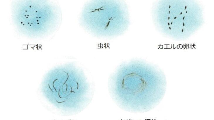 飛蚊症、サプリメントなどで治ることはない