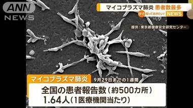 マイコプラズマ肺炎の患者数が過去最多