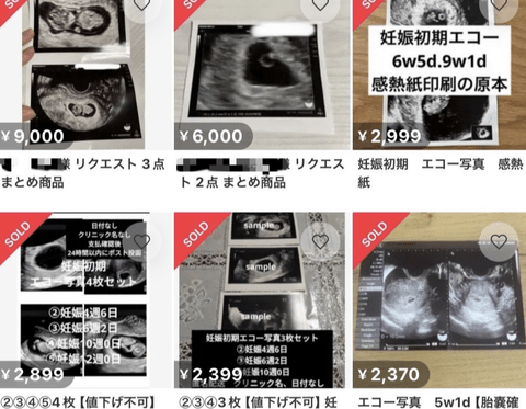 【悲報】メルカリ、胎児のエコー写真の出品禁止