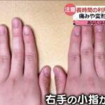 【悲報】｢スマホ指｣とかいうガチで社会問題