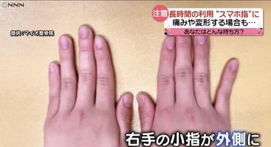 【悲報】｢スマホ指｣とかいうガチで社会問題