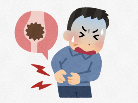 【悲報】尿路結石ワイ、つらすぎる