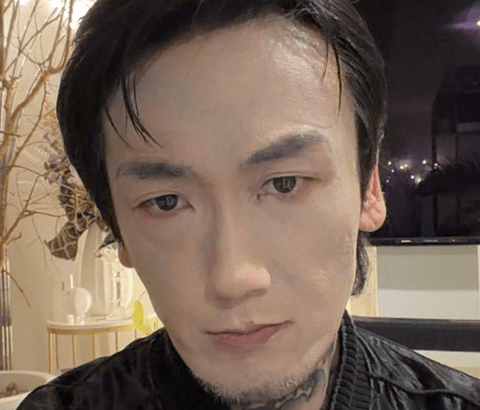 【悲報】瓜田純士さん「顔のタトゥーを消してみた」