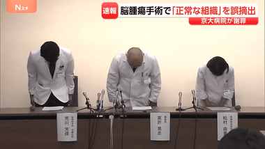 京大病院､脳腫瘍手術で｢正常な組織｣を誤って摘出する手術ミス 通常の生活送っていた患者が自発呼吸不能の重篤状態に